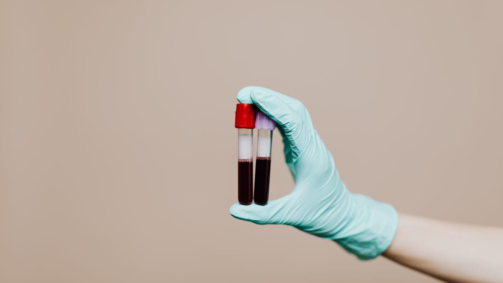 A CBC is three tests stapled together