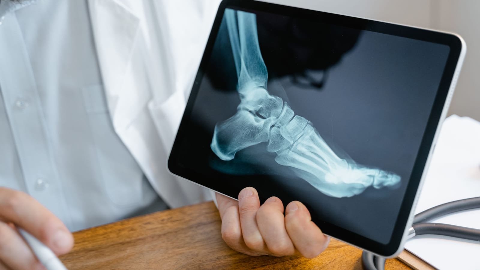Gout wakes you at 2 a.m. and diet alone won't fix it