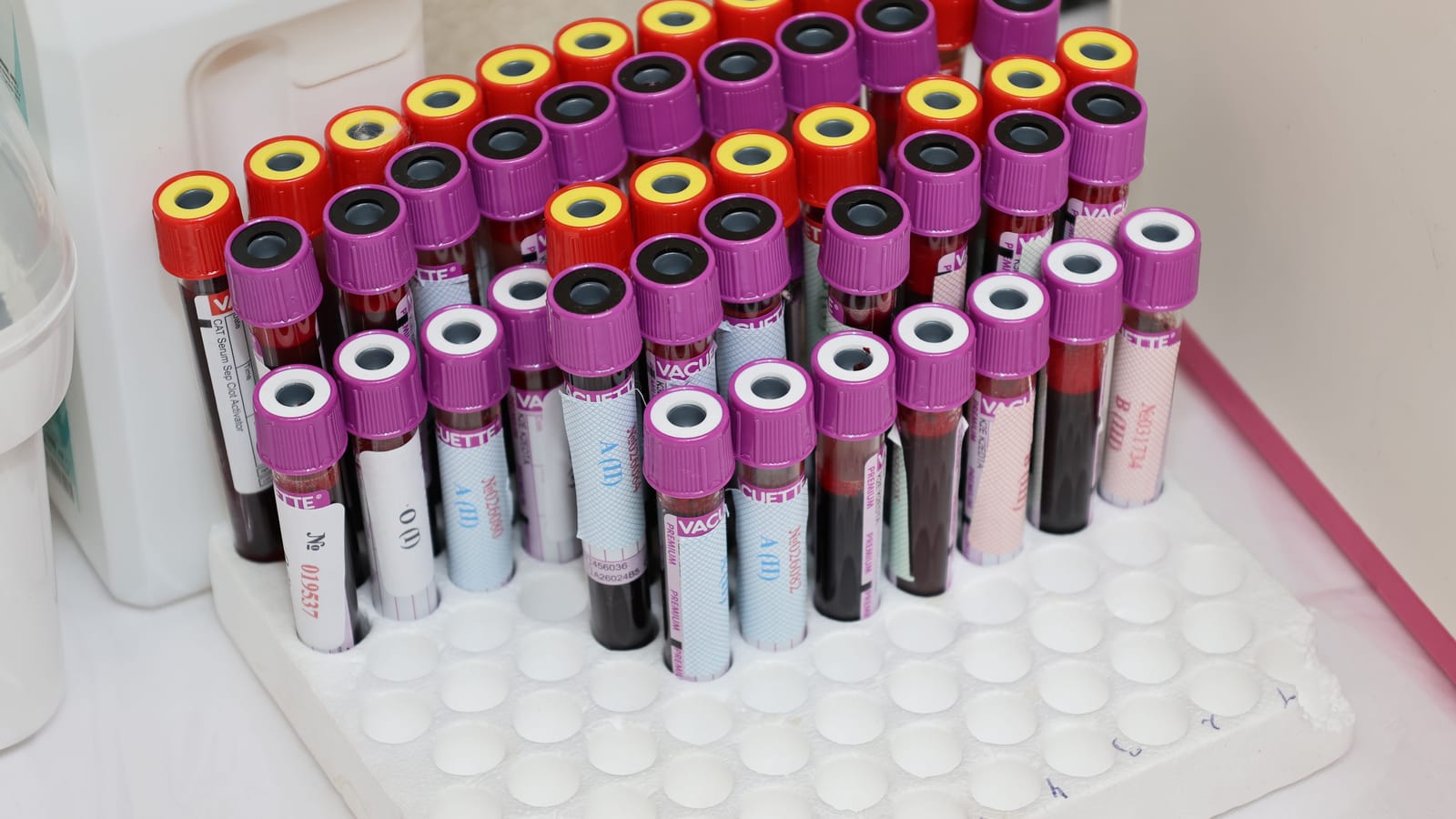 How to Read Your Cholesterol Panel Without Panicking