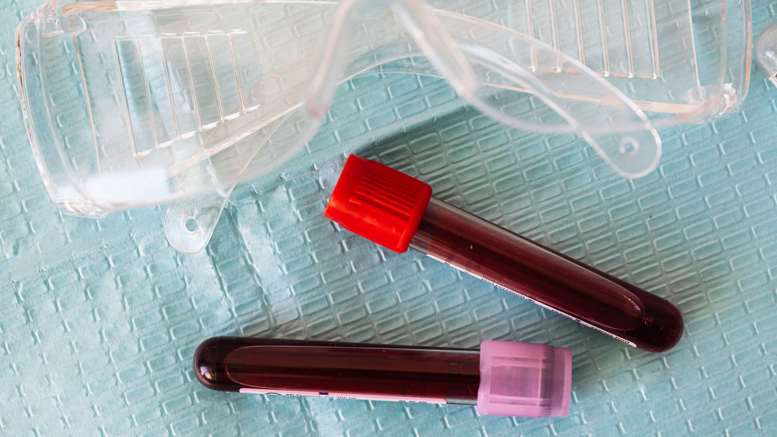 Normal hemoglobin doesn't mean your iron is fine