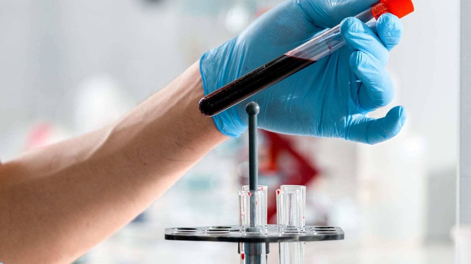 Test your testosterone before 10 a.m. and do it twice
