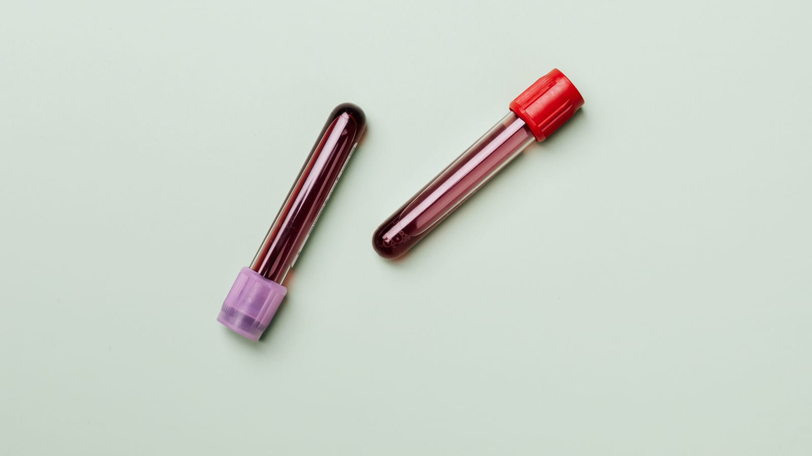 What a blood panel measures and which numbers to watch